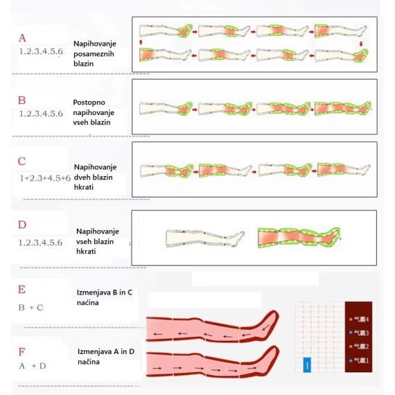 Načini šresoterapije